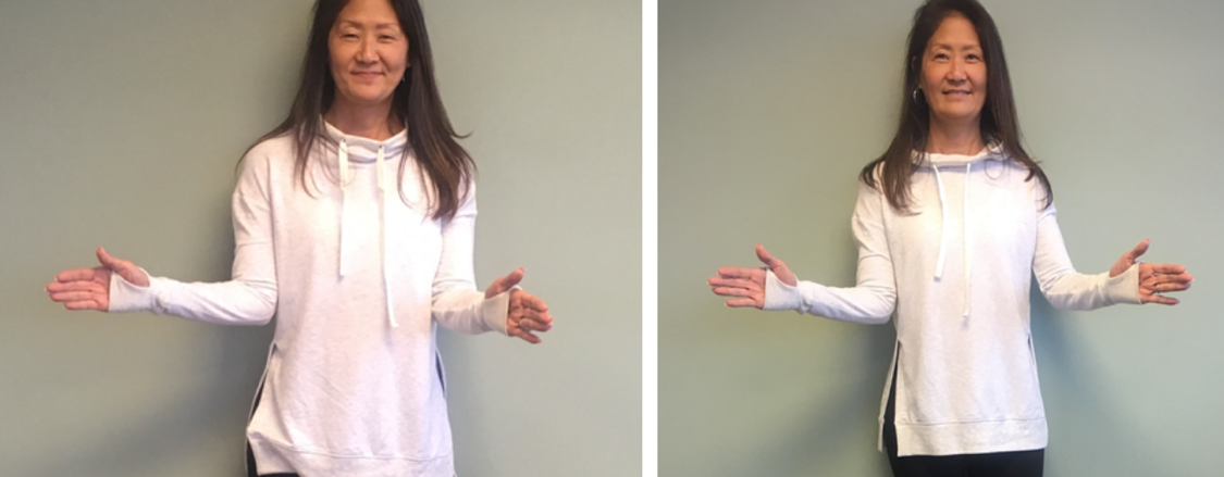 Shoulder Before:After 1.png