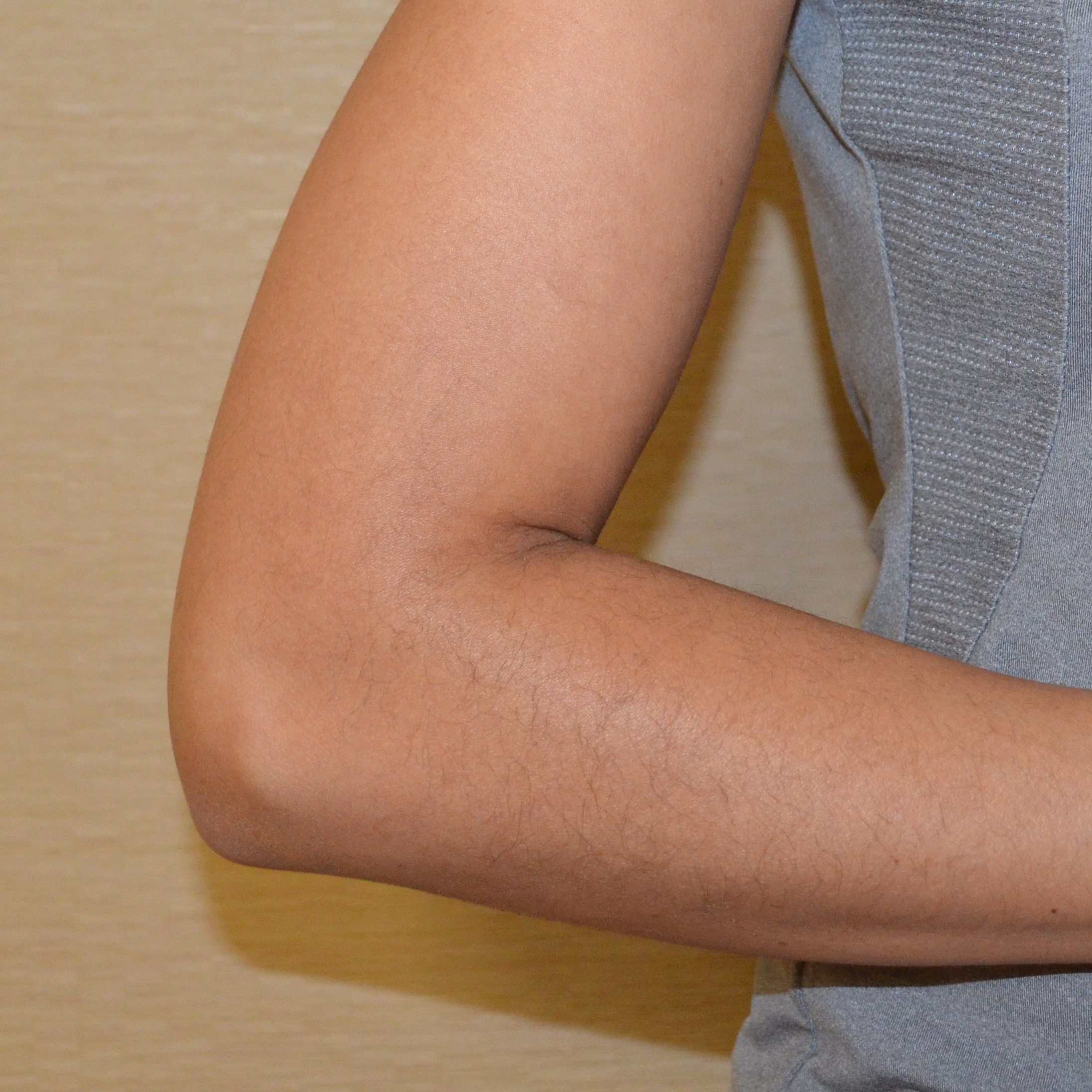 ELBOW