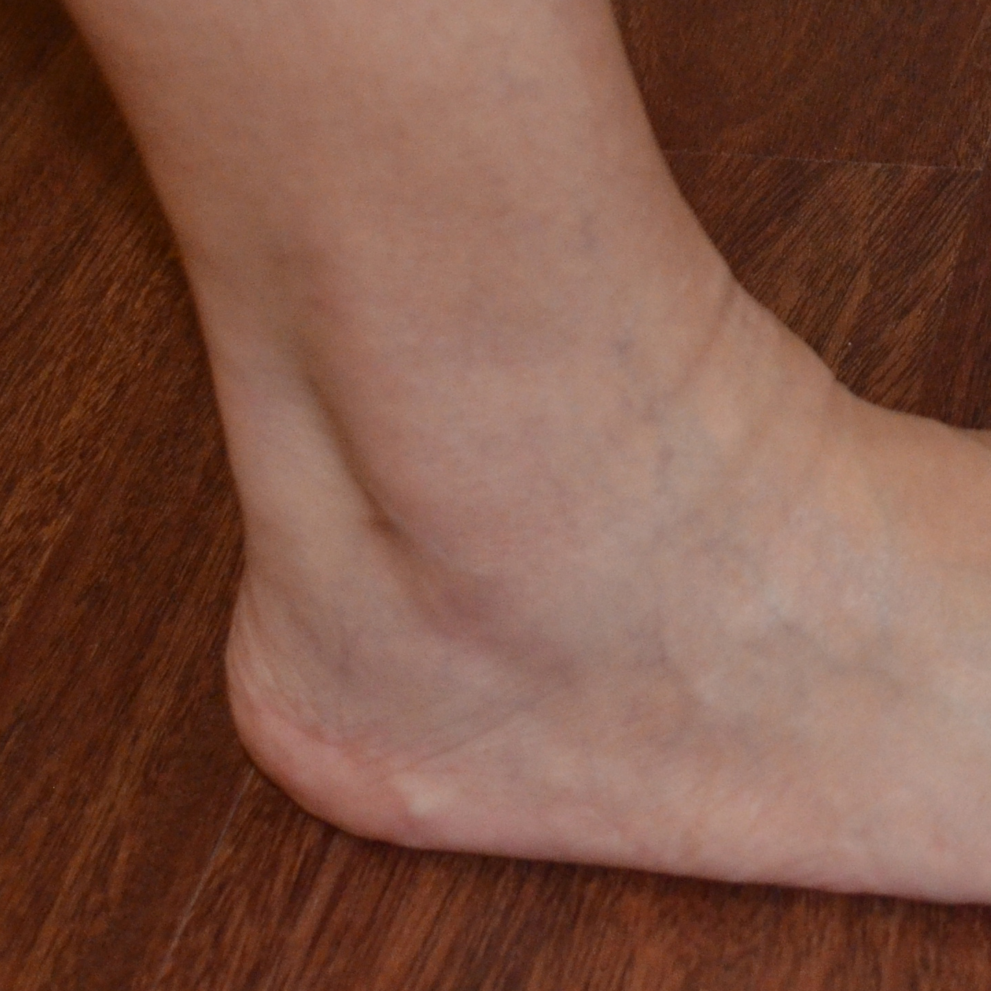 ANKLE