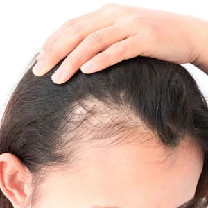 hair.jpg