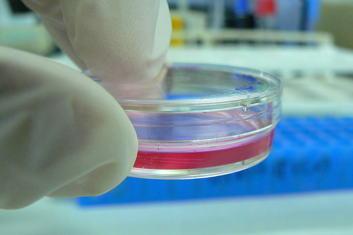 By kaibara87 - originally posted to Flickr as Cell Culture, CC BY 2.0, https://commons.wikimedia.org/w/index.php?curid=5618734