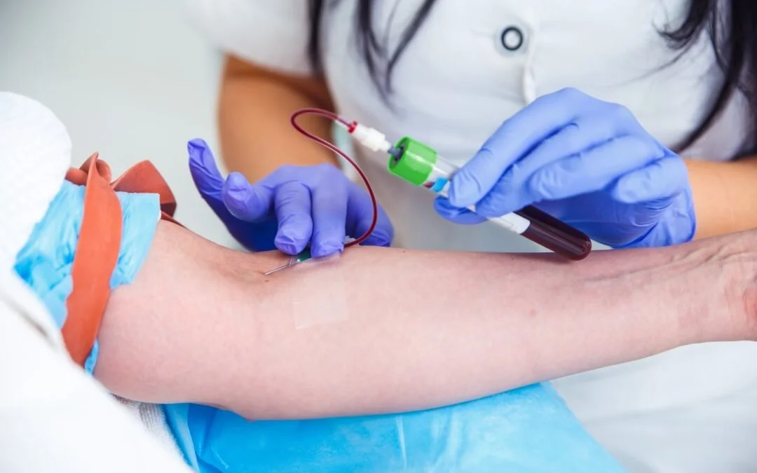 importance-of-an-ekgphlebotomy-technician-1080x675.jpg