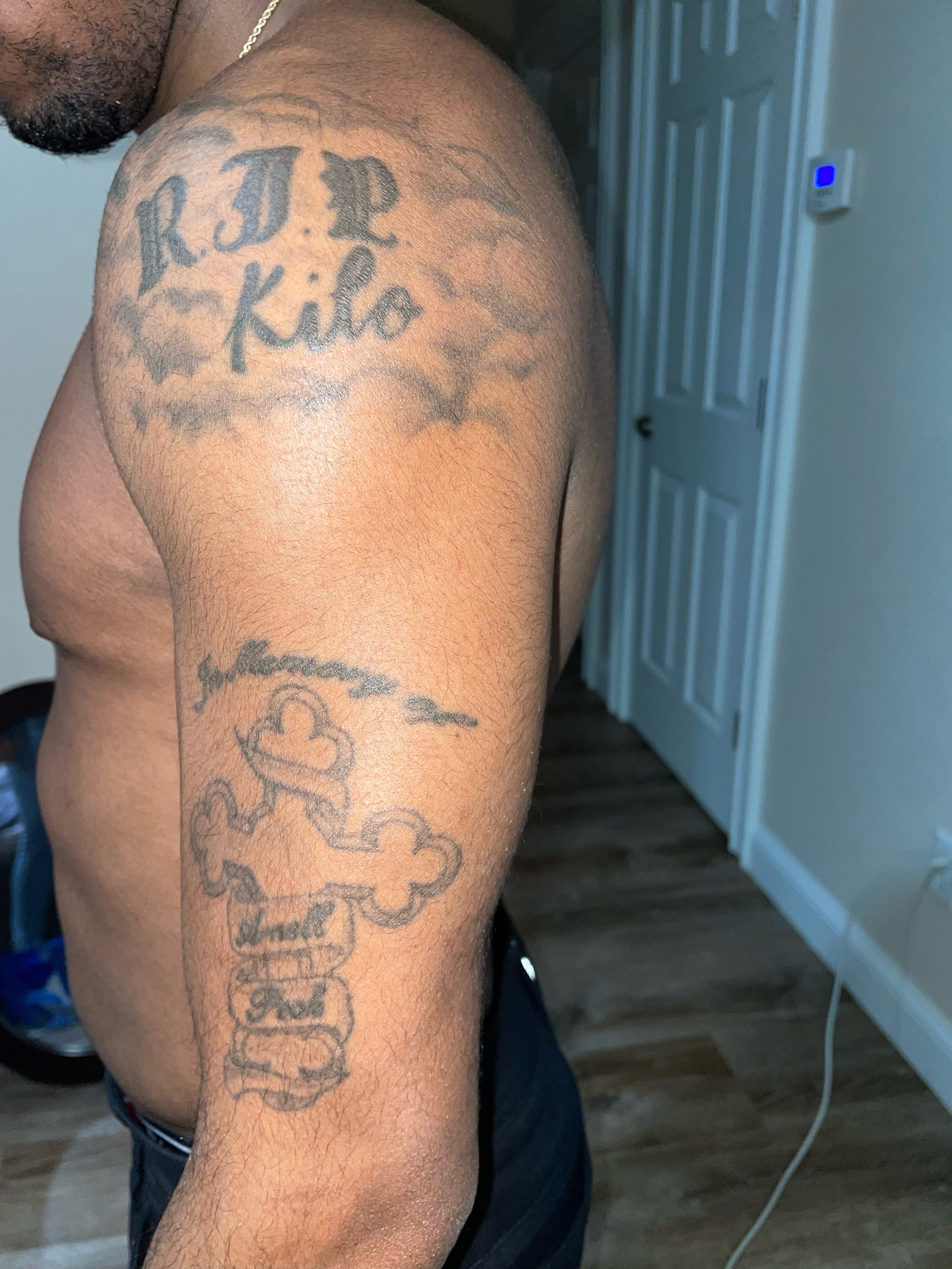 Before tattoo coverage