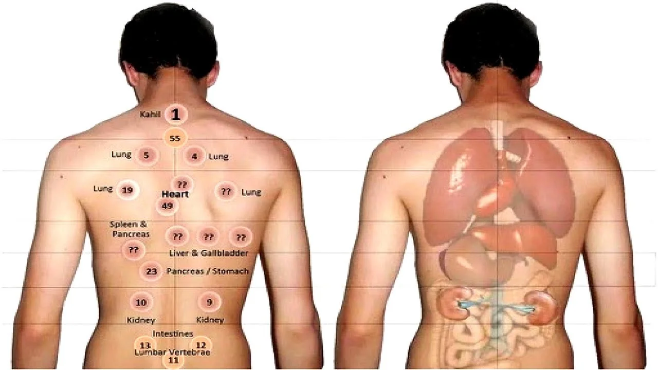 cupping2.jpg