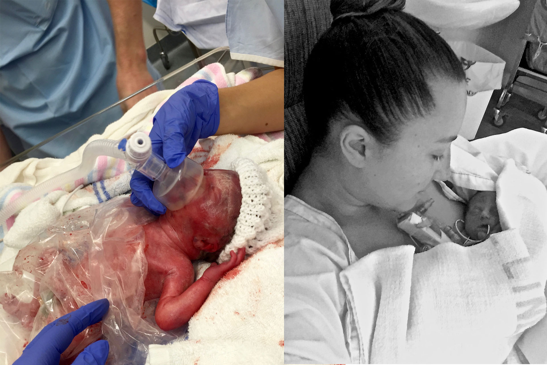 Left: Remy only moments old. Right: Anisa holding her daughter for the first time after 5 days. 