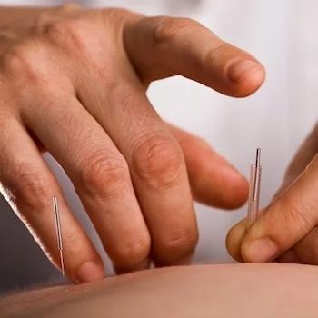 Ancient Elements Acupuncture