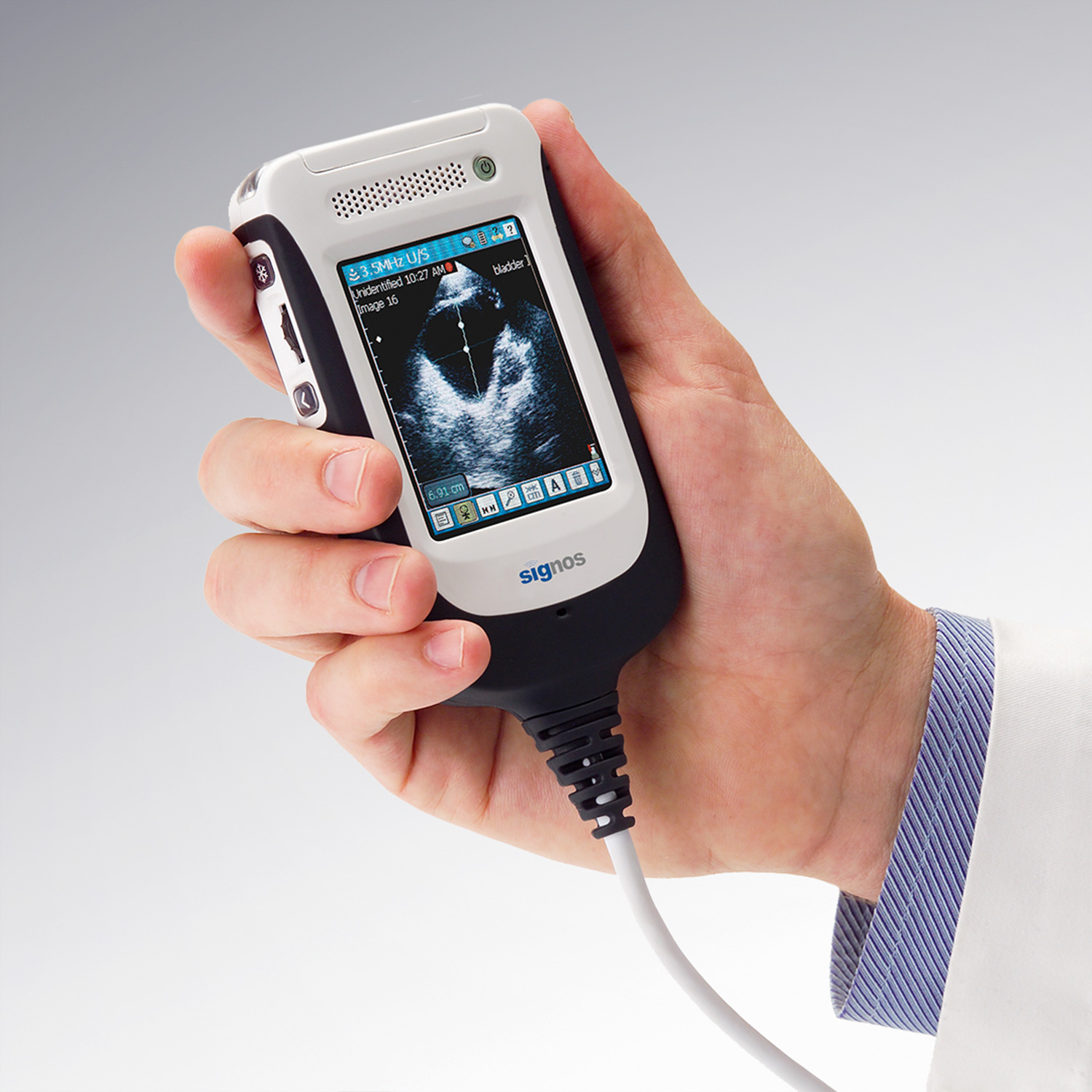 Signostics -Ultrasound System-In hand-1x1.jpg