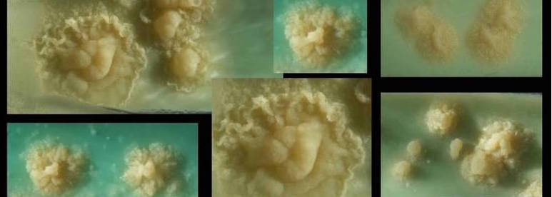 image © Hans Newman microbiologyinpictures.com
