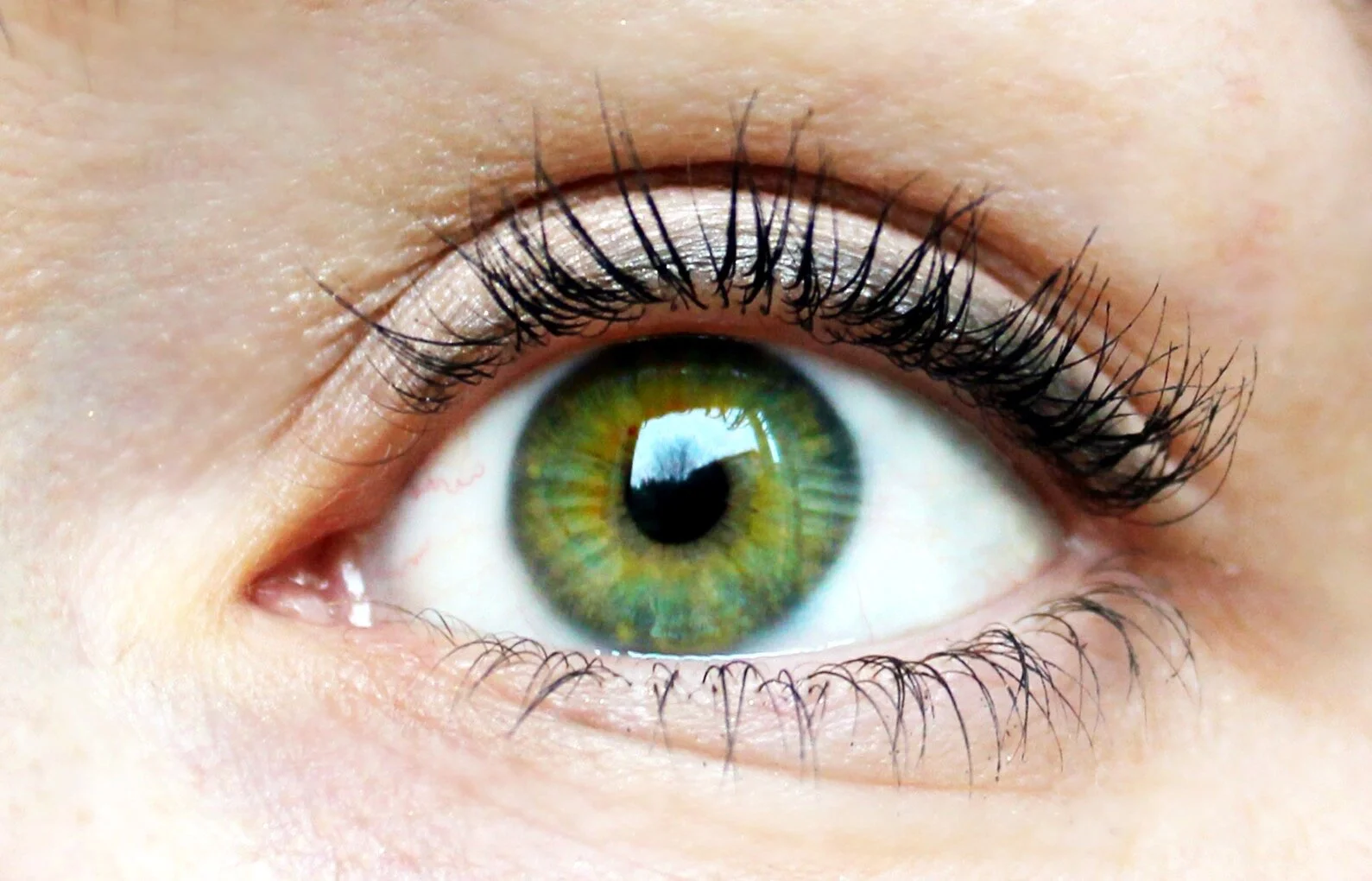Say 'No Thank You' to dark circles &amp; puffiness under the eyes