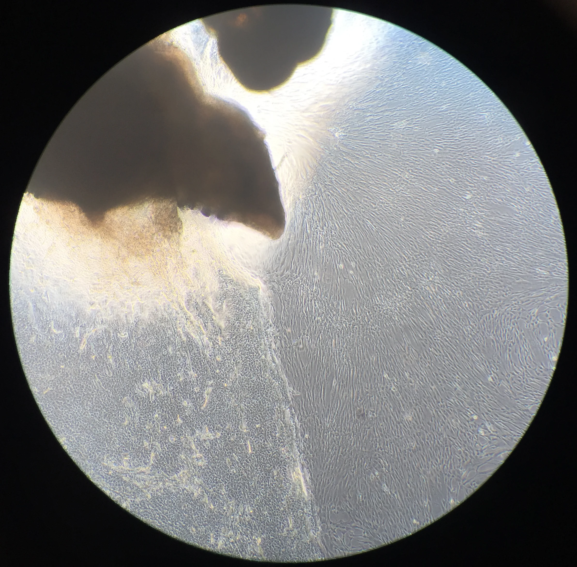 The first stage of Phil's growing 'mini-brain'. Biopsy through the eye piece with an iPhone, using a light microscope. Image: Chris Lovejoy and Charlie Arber, UCL Institute of Neurology.