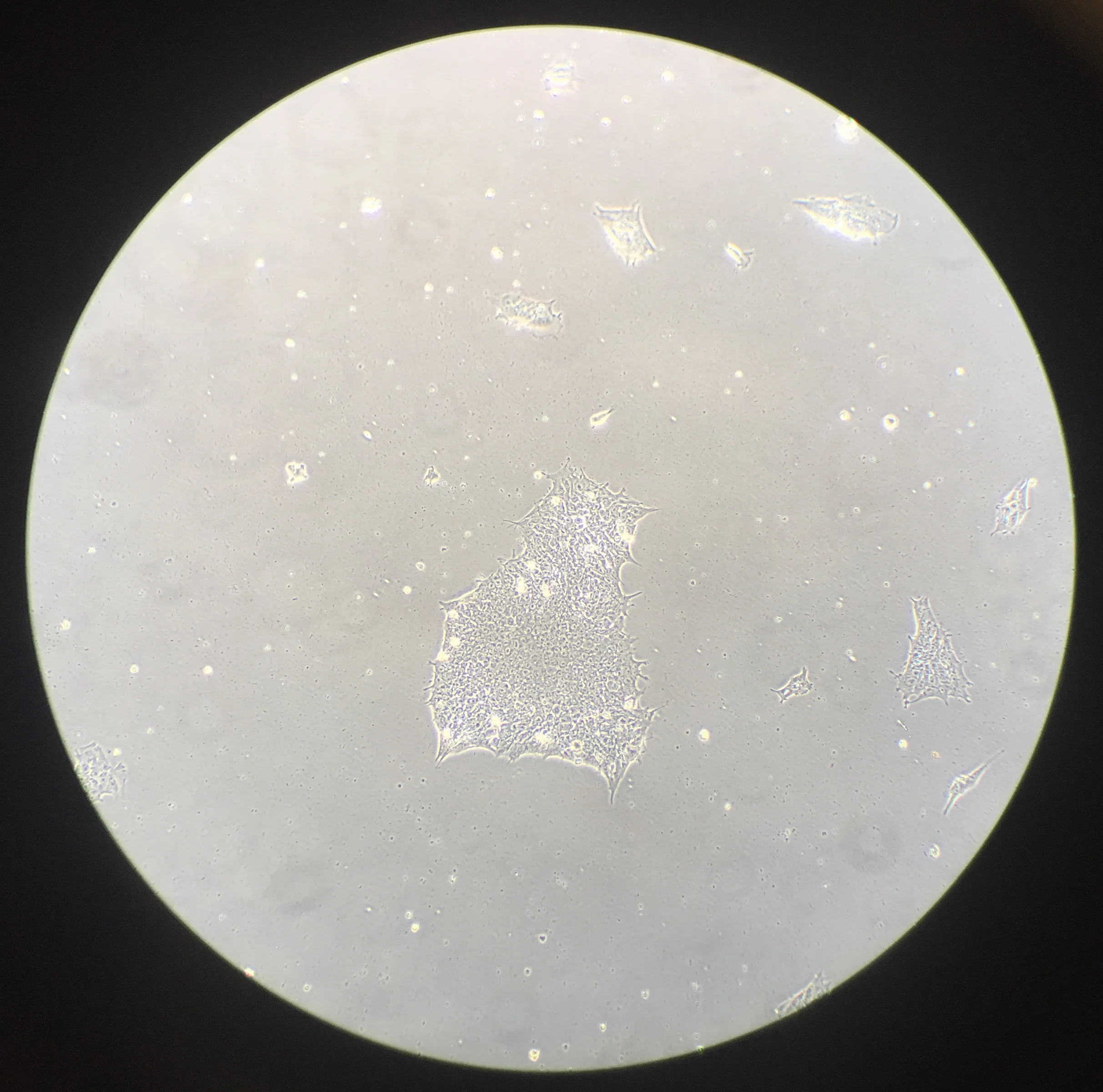 Philip Ball's cells during conversion of skin cells to neurons. This shows a colony that has been transformed to a stem cell-like state. Image: Selina Wray and Christopher Lovejoy, UCL. 