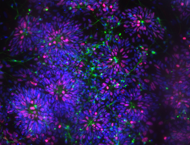 Human neurons grown from stem cells, stained for the proteins Ki67 (red) and tau (green) © 2017. Image: Wray Lab, UCL