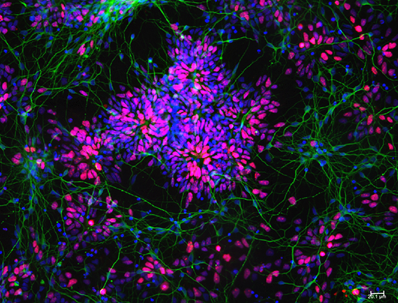Human neurons grown from stem cells, stained for the proteins Ki67 (red) and tau (green) © 2017. Image: Wray Lab, UCL