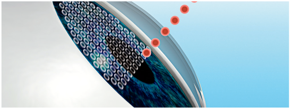 step2_lasik.png