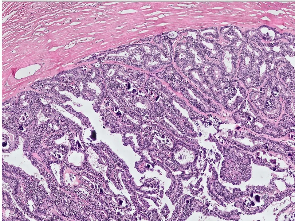 Papillary Icon.jpg