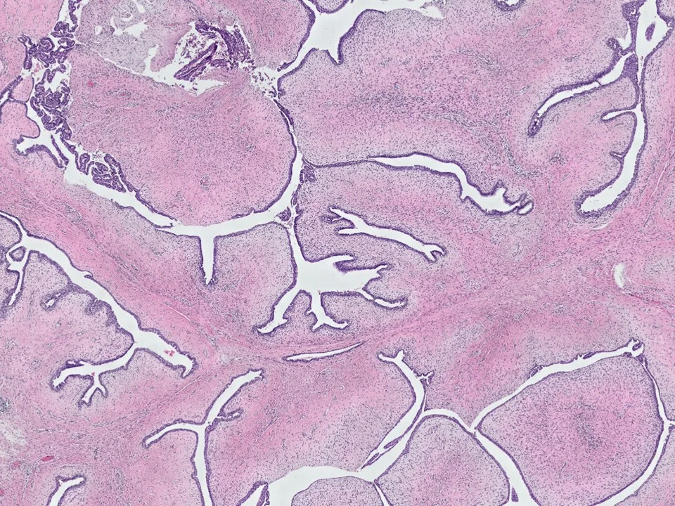 Fibroepithelial Icon.jpg