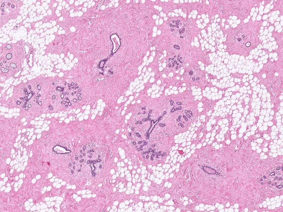 Normal Breast Tissue