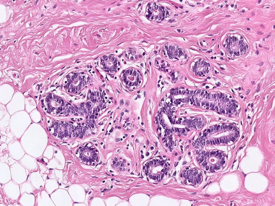 Normal Breast Tissue, Lobule