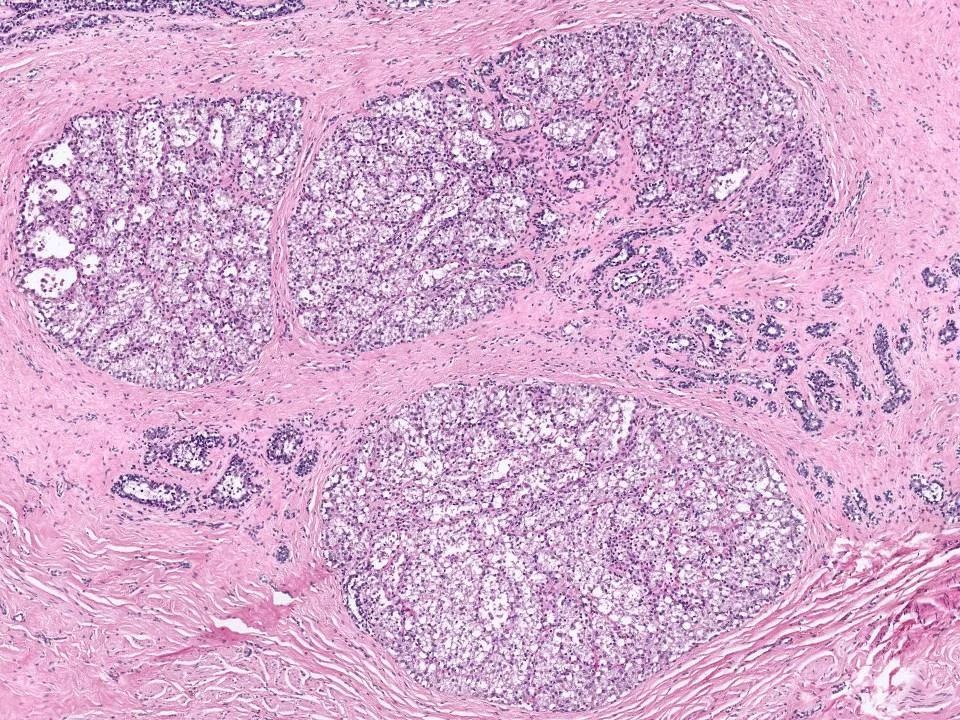 Lactating Breast Tissue