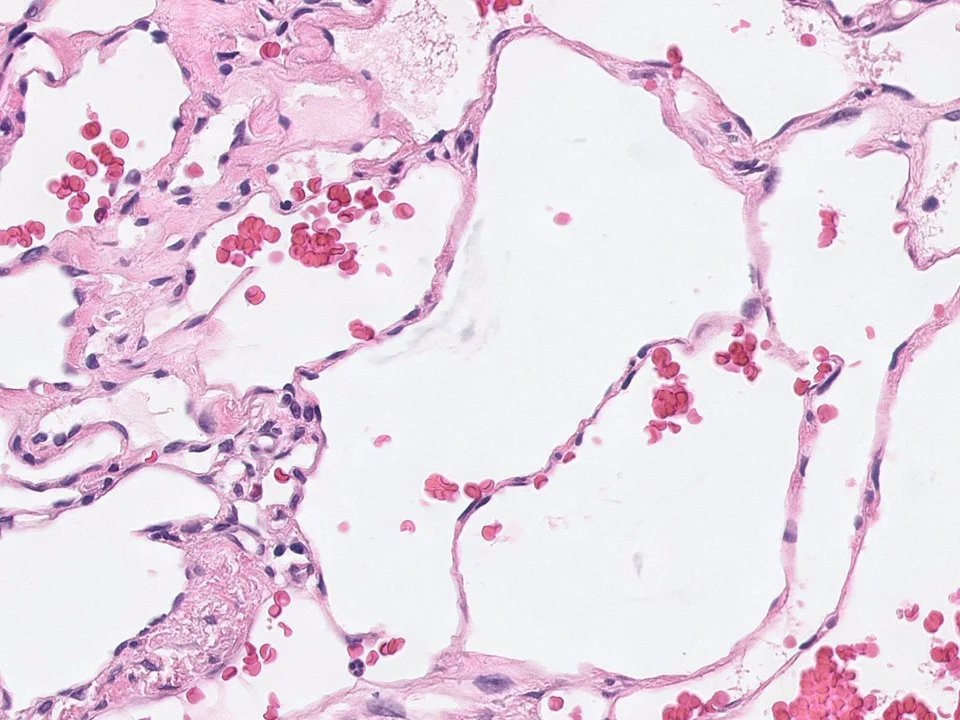 Vascular Icon.jpg