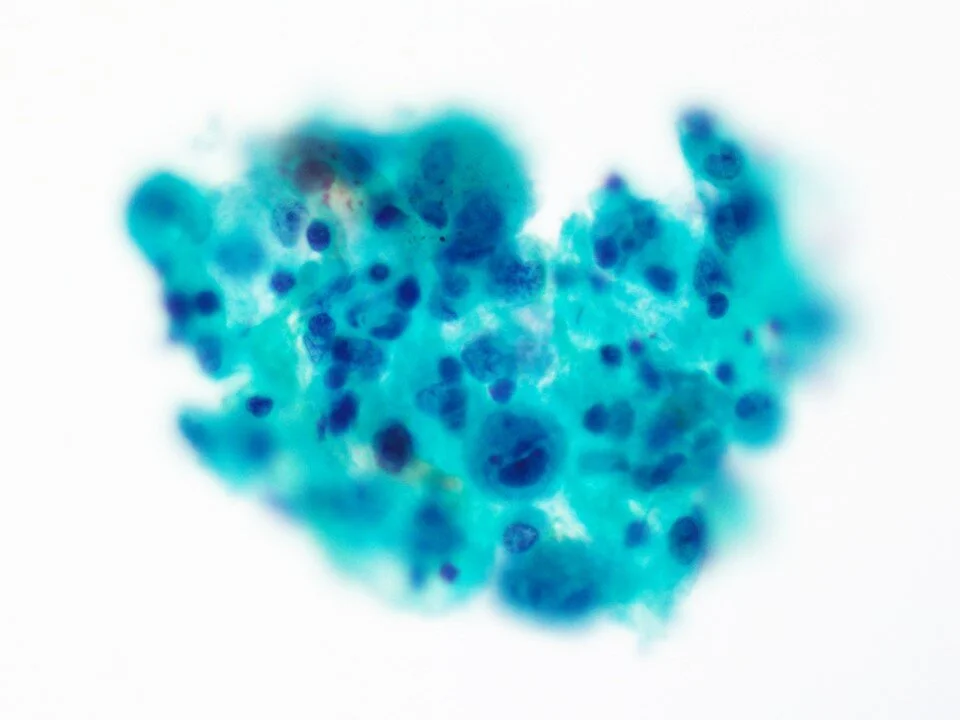 Cytomegalovirus