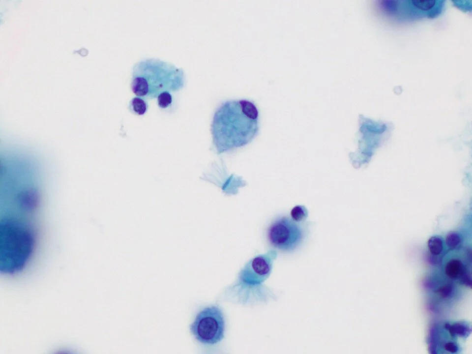 Ciliocytophthoria