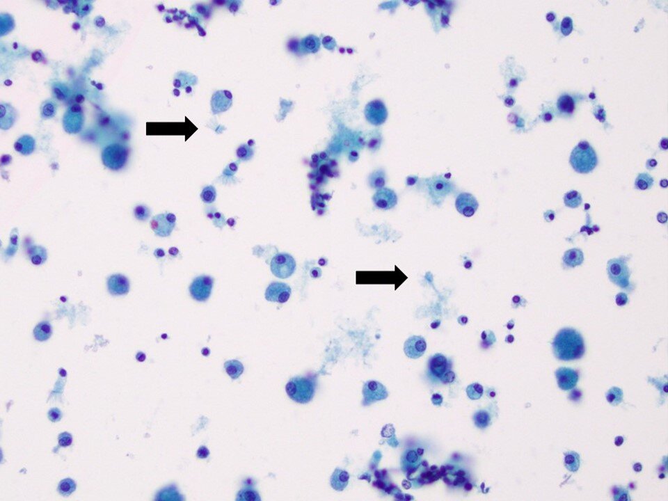 Ciliocytophthoria