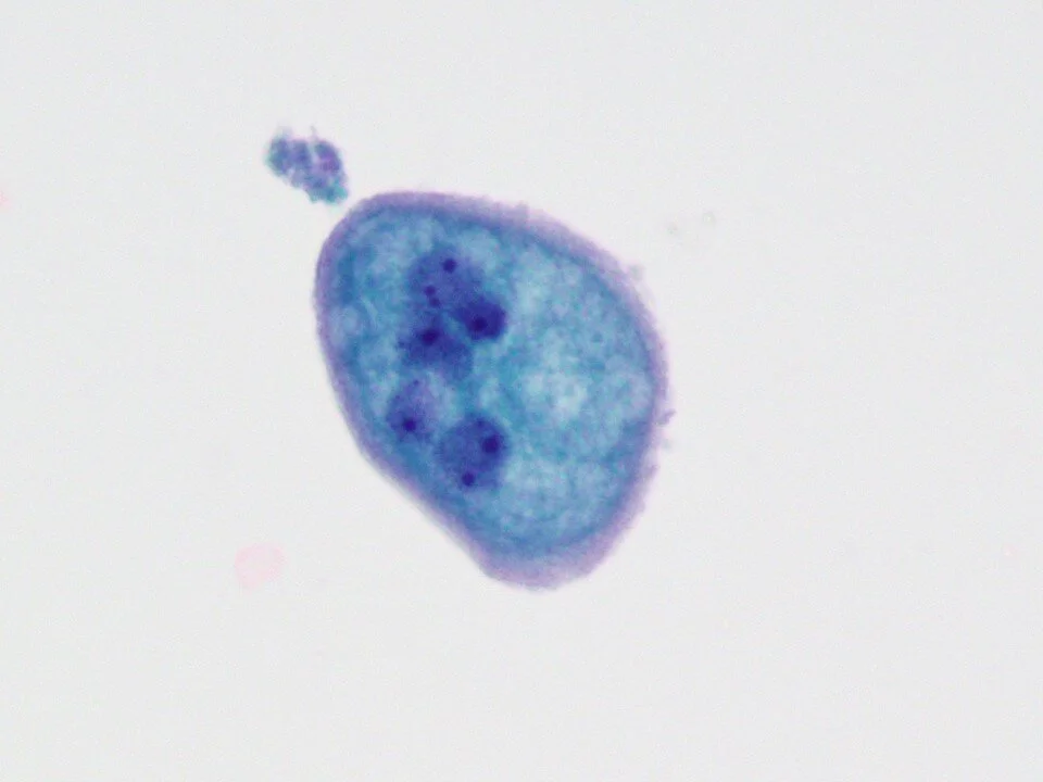 Normal element - umbrella cell