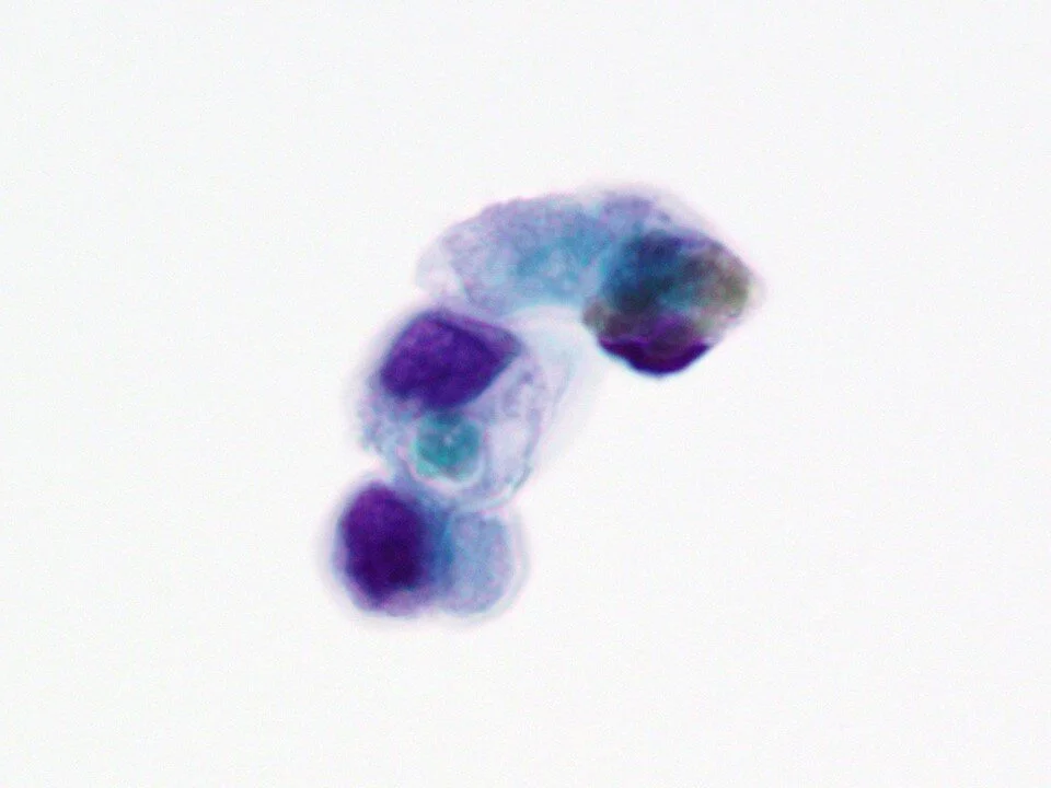 Seminal vesicle cells