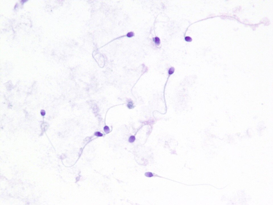 Sperm