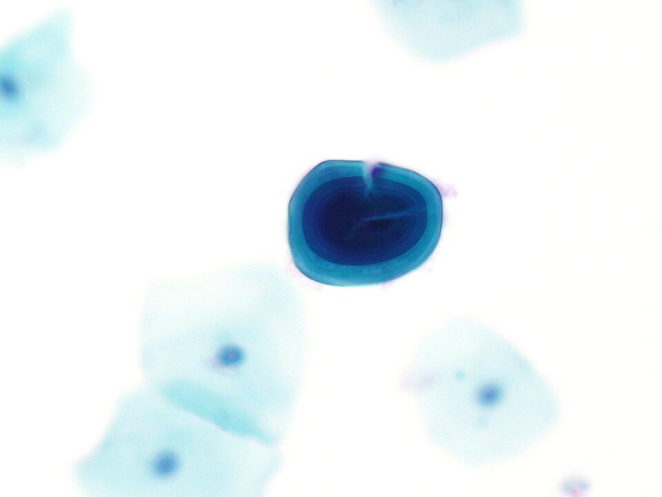 Corpora amylacea