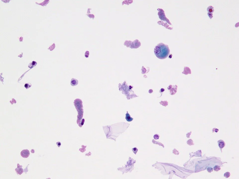Granular casts