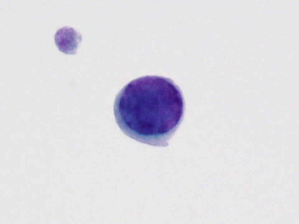 Polyomavirus