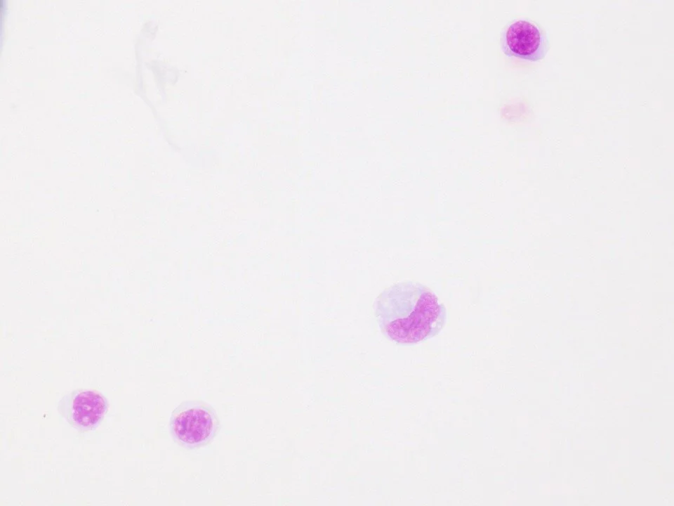 Normal elements - Lymphocytes and Monocytes