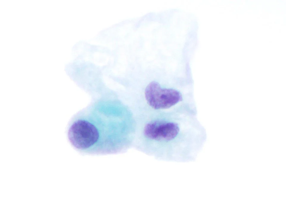 Choroid Plexus Cells