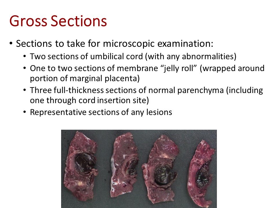 Slide15.JPG