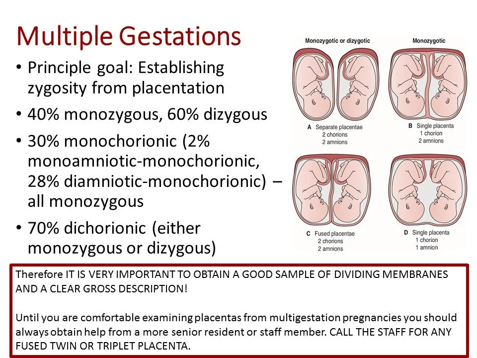Slide69.JPG