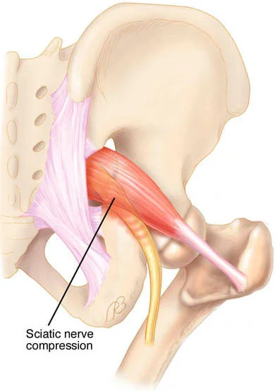 piriformis.jpg