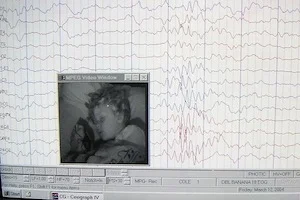 Epilepsy, scanning and EEG: Understand the clinical trials of Epi-Care mobile