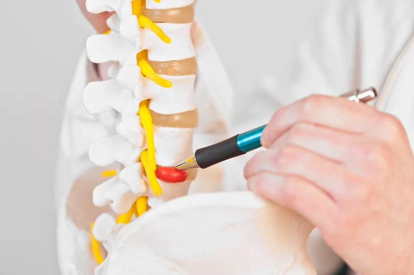 How to Prevent Disc Problems