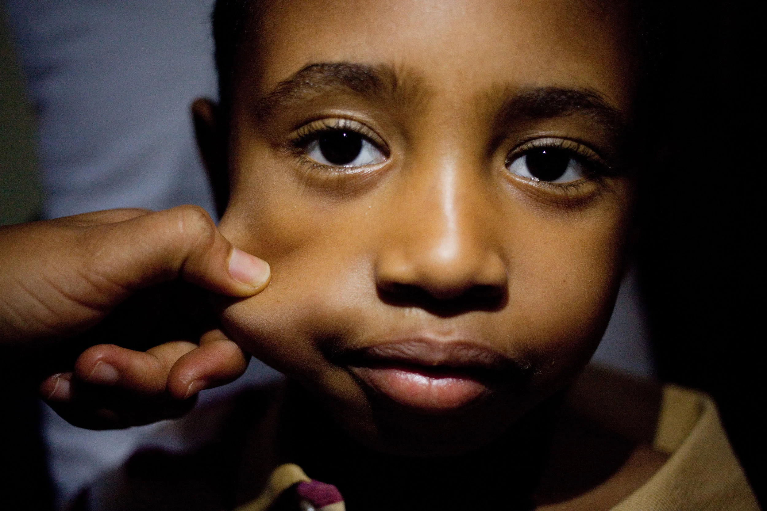  Sisay's cheek is pinched by another spine patient while posing for an iPhone-lit portrait. 