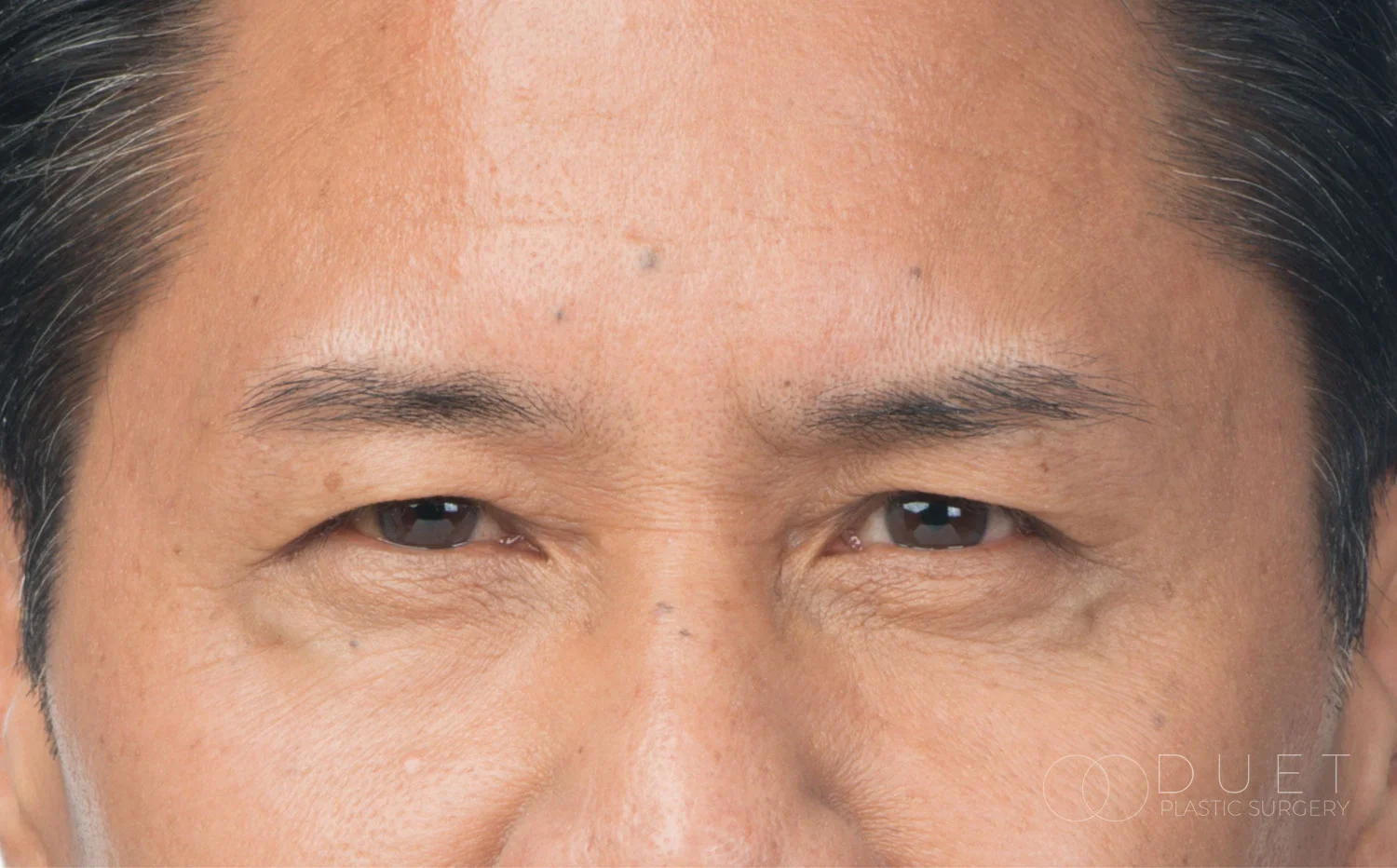 clint_front_after-watermarked.jpg