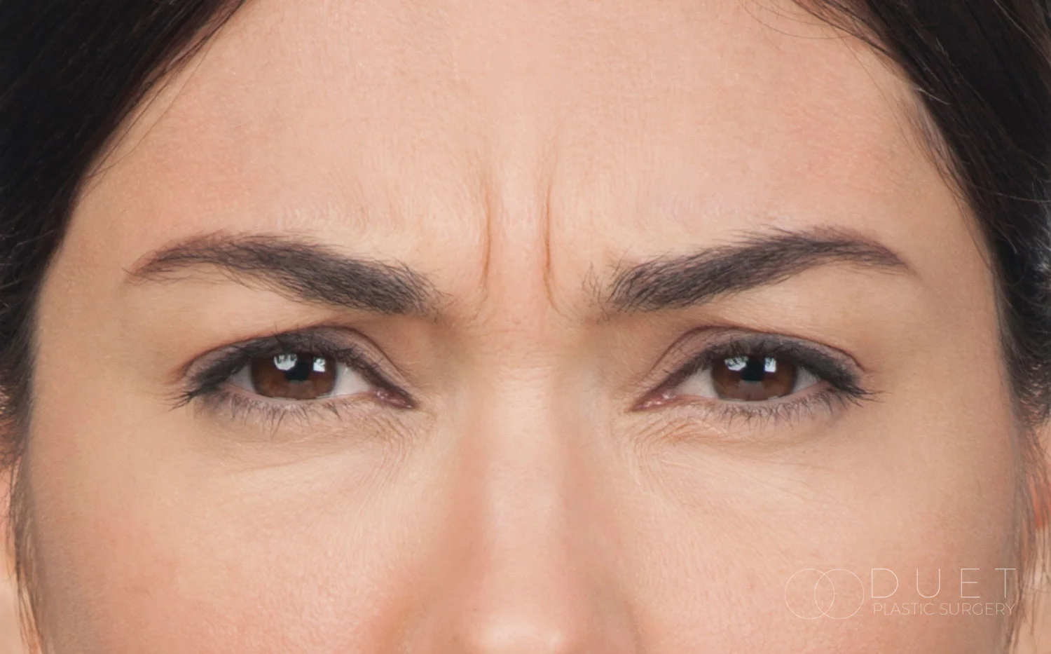 cynthia_front_before-watermarked.jpg