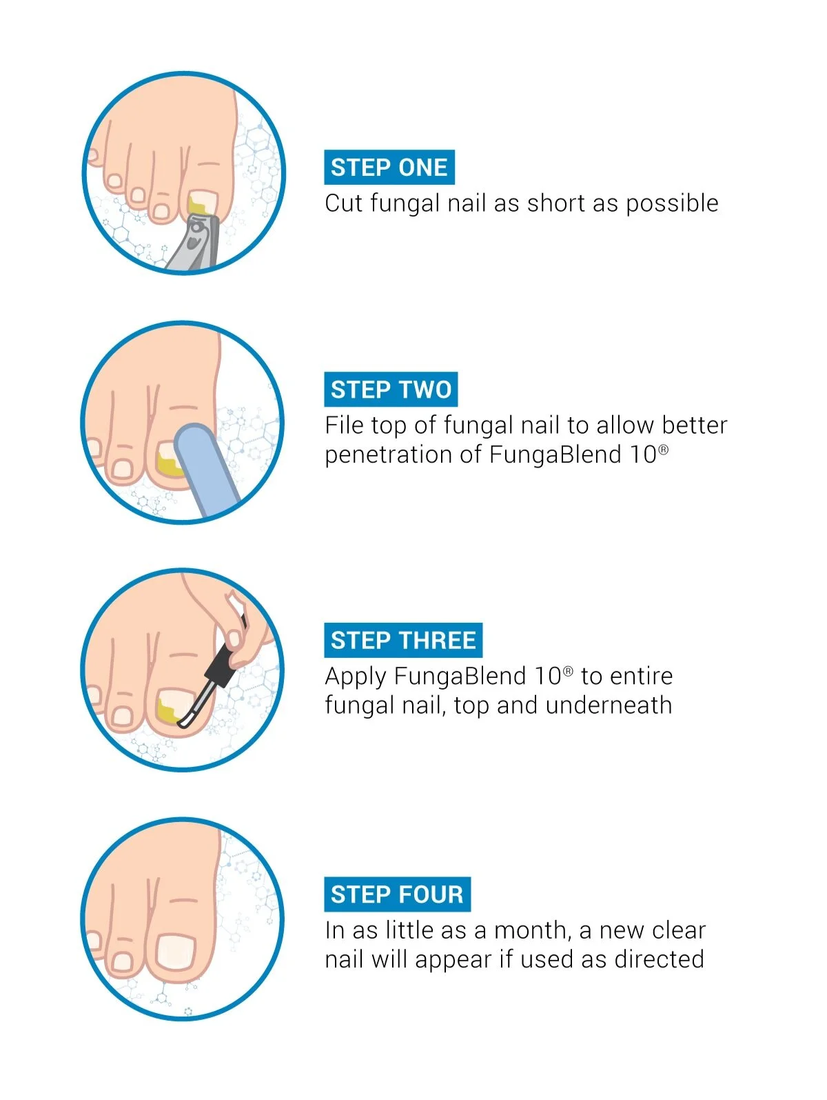 How to Cure Your Toenail Fungus Topical Aintifungal Solution