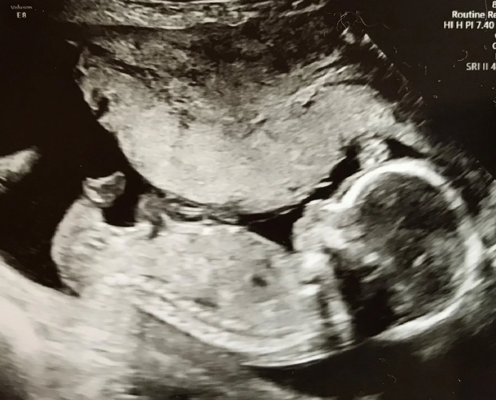 nugget 18weeks.jpg