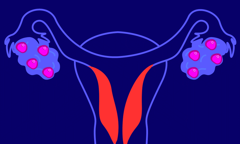 gif of the uterine lining shedding