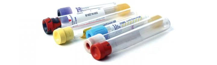 lab-testing-vials_0.jpg