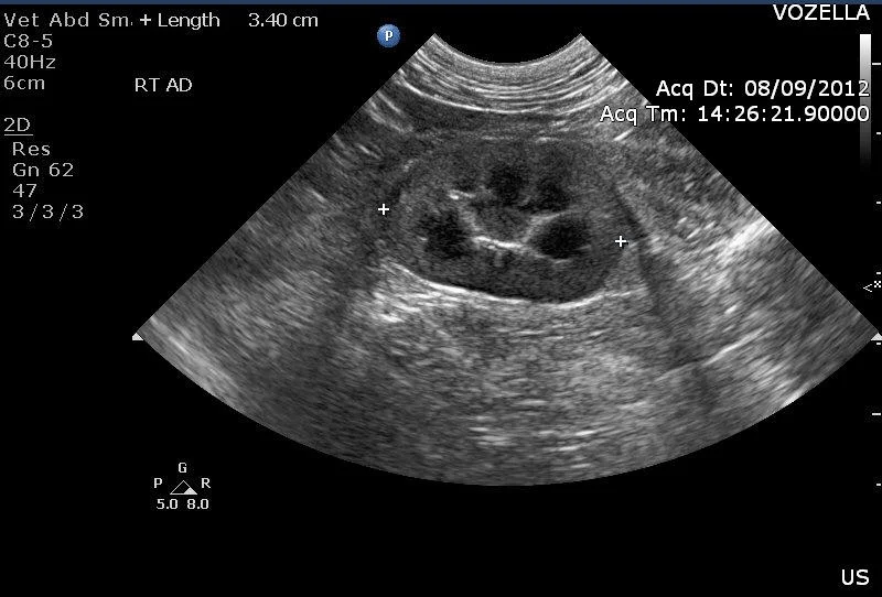 kidney US.jpg