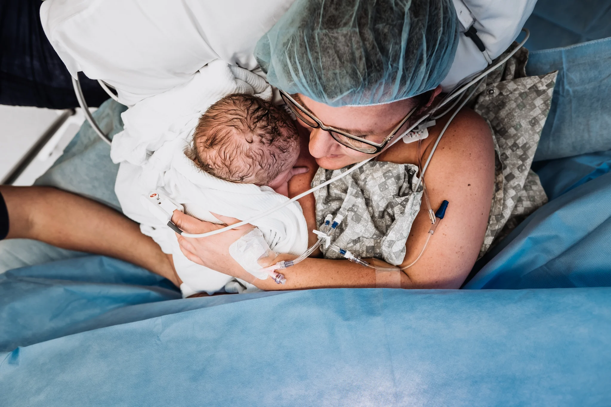 Green Bay Cesarean
