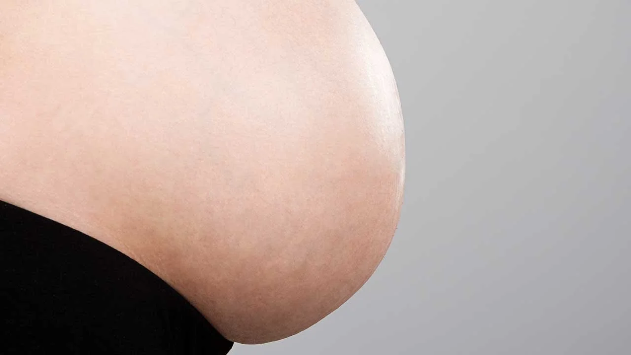 How to Remove Stretch Marks in Photoshop